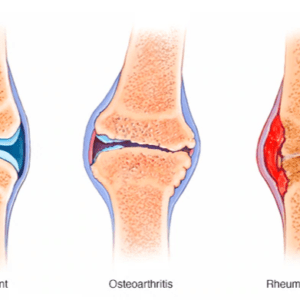 Arthritis Herbal powder